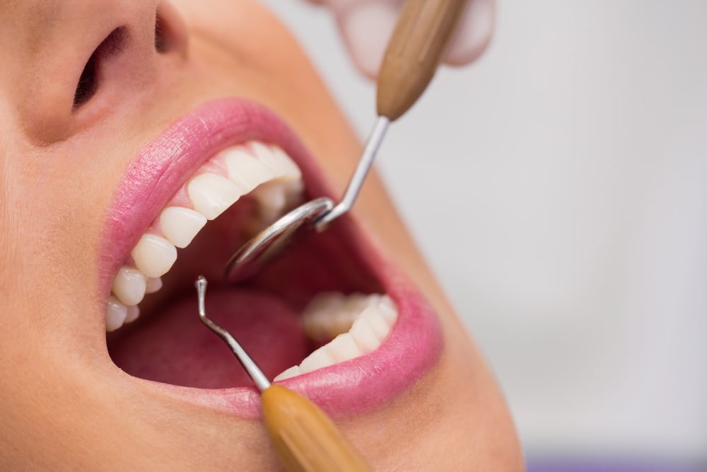 que es un curetaje dental