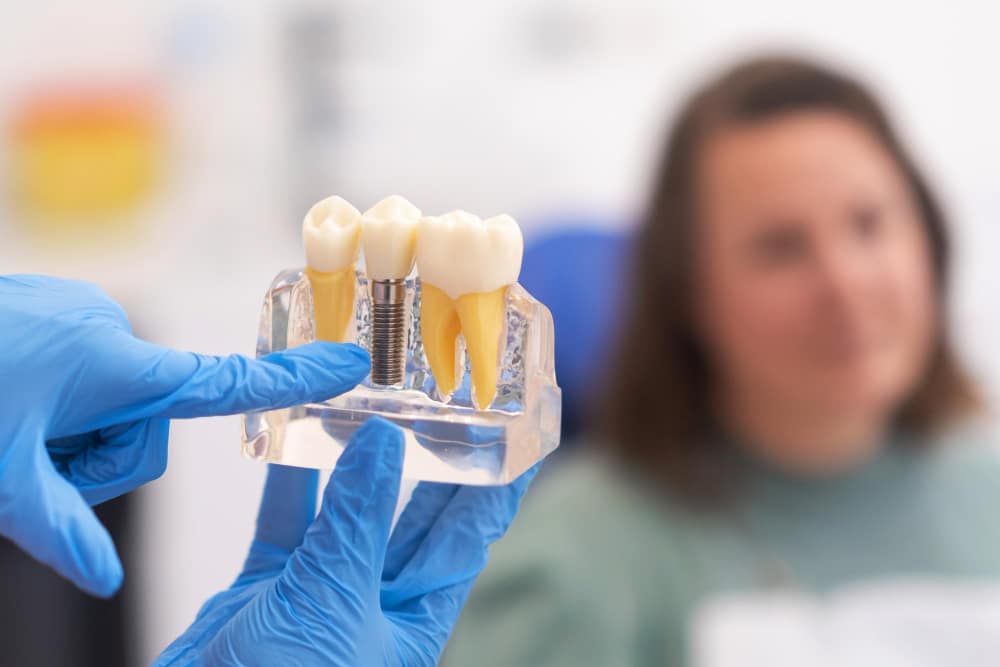 cuales son los sintomas del rechazo de implantes dentales