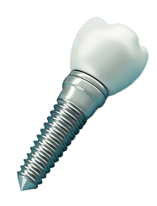 Clinica dental en madrid norte las tablas quintero dental