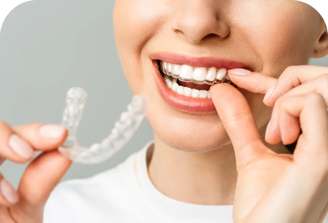 Clinica dental en madrid norte las tablas quintero dental