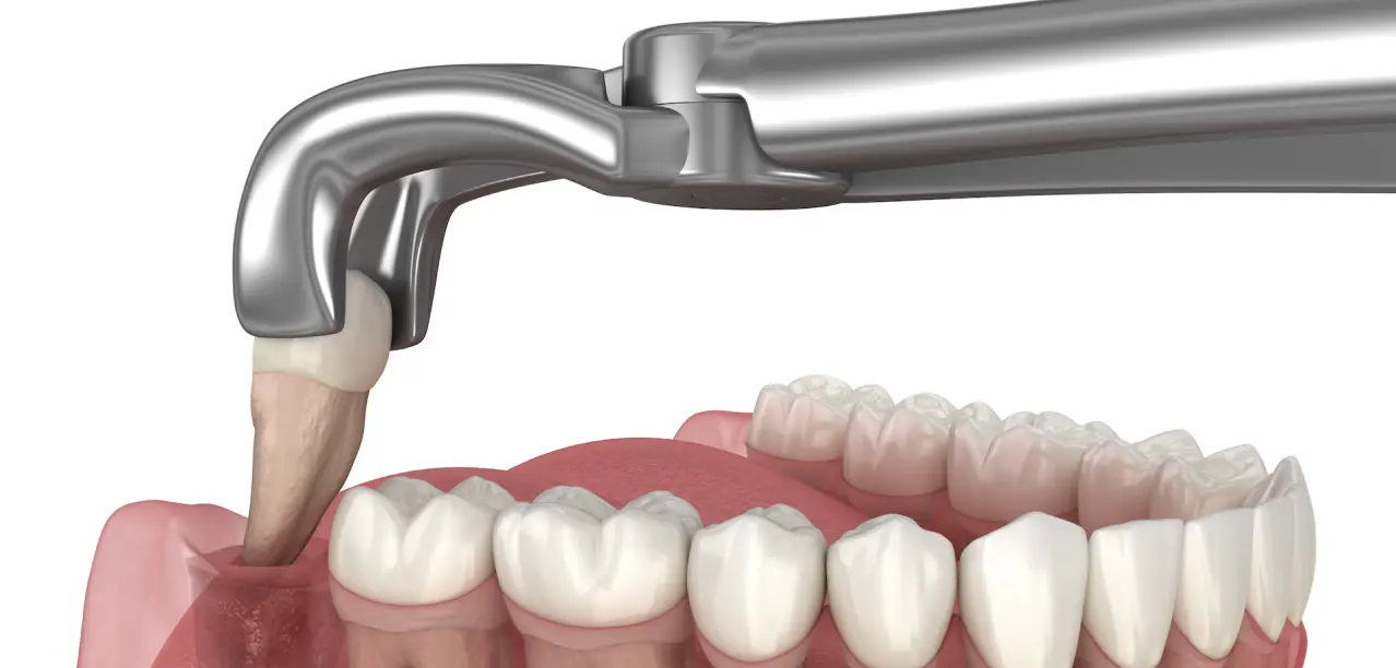 Clinica dental en madrid norte las tablas quintero dental