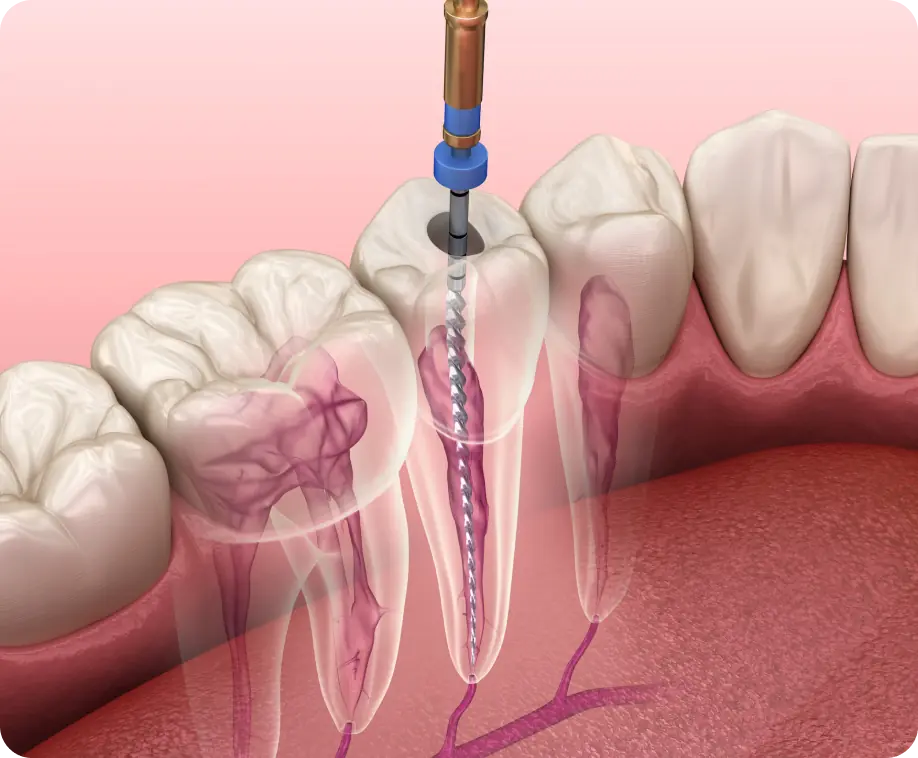 Clinica dental en madrid norte las tablas quintero dental