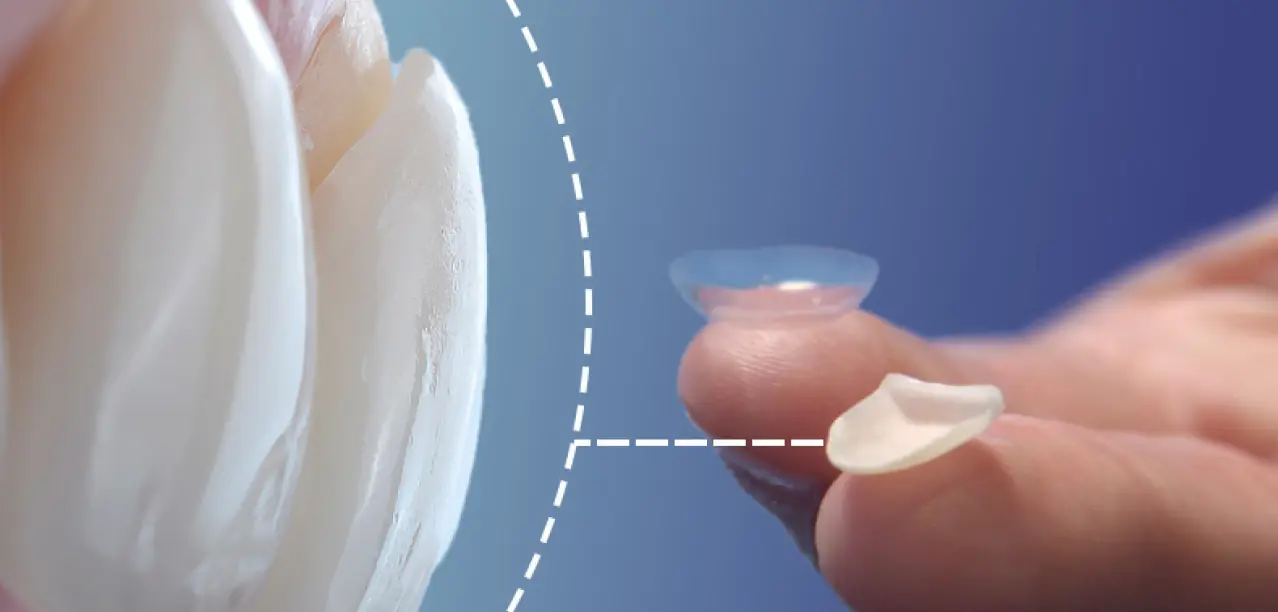 Clinica dental en madrid norte las tablas quintero dental