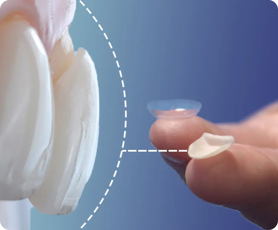 Clinica dental en madrid norte las tablas quintero dental