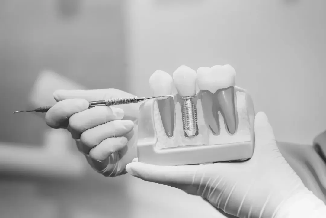 Clinica dental en madrid norte las tablas quintero dental