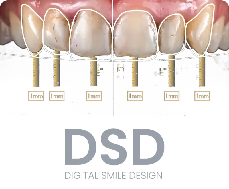 Clinica dental en madrid norte las tablas quintero dental