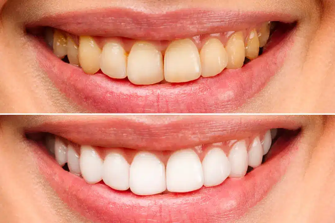 Clinica dental en madrid norte las tablas quintero dental