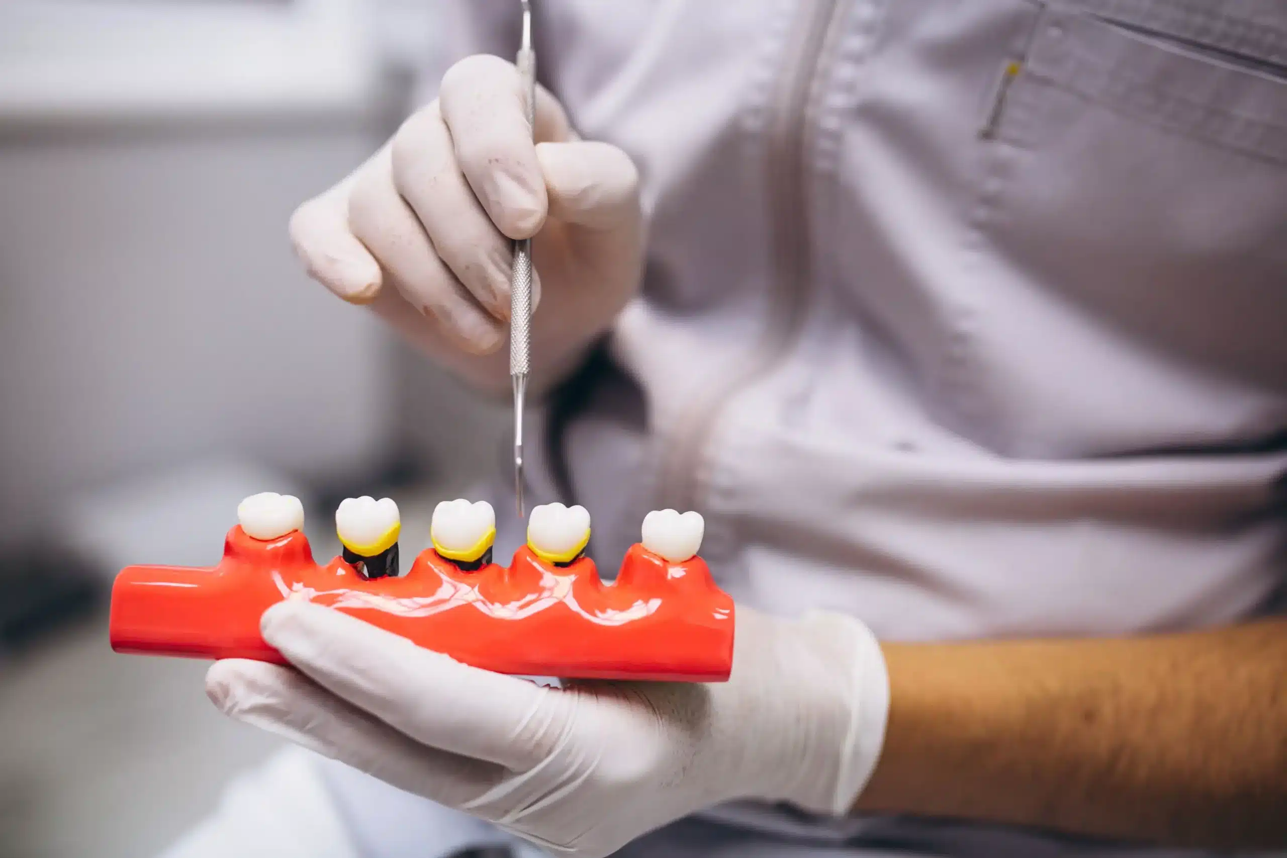 Clinica dental en madrid norte las tablas quintero dental