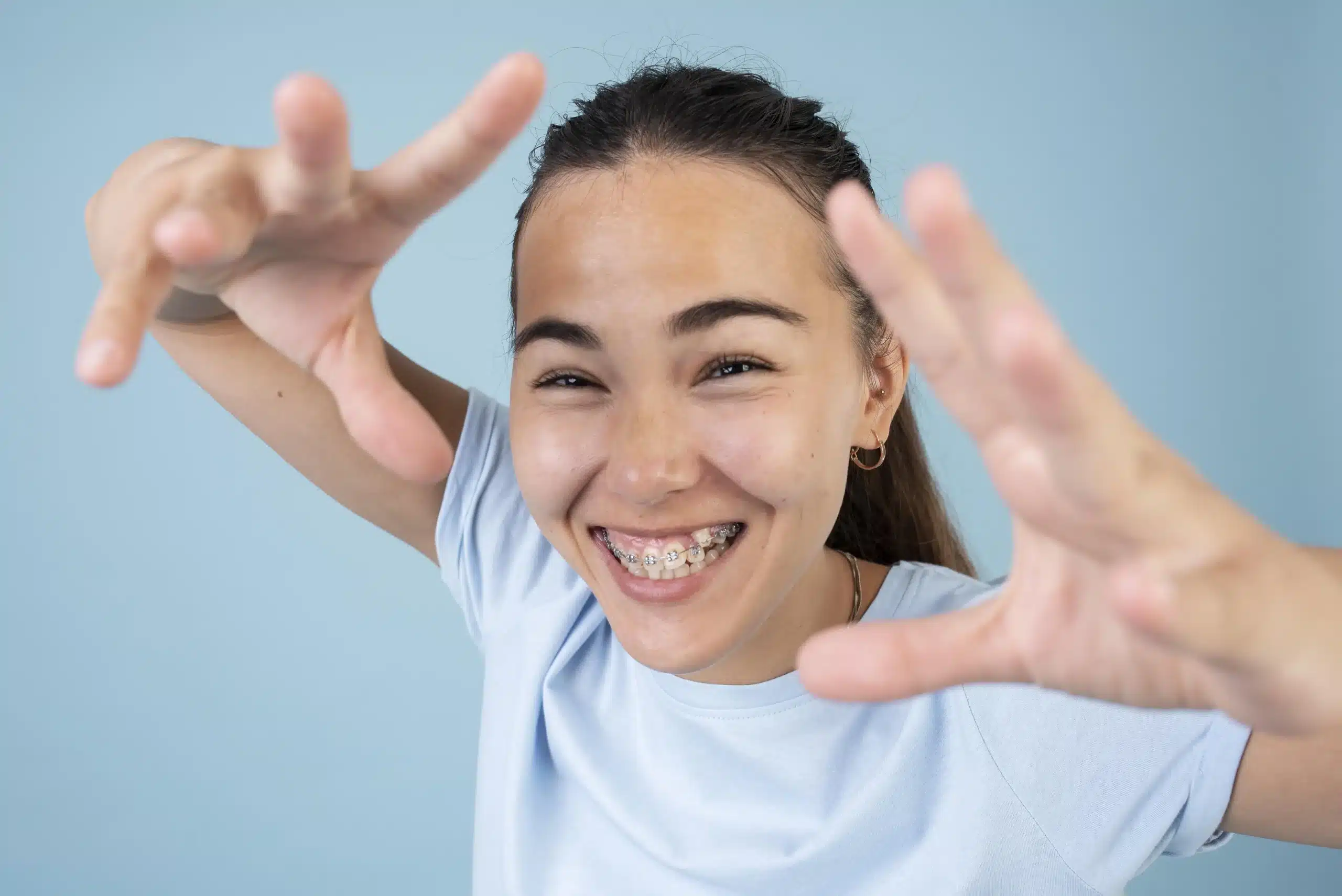 Apiñamiento Dental en madrid las tablas quintero dental