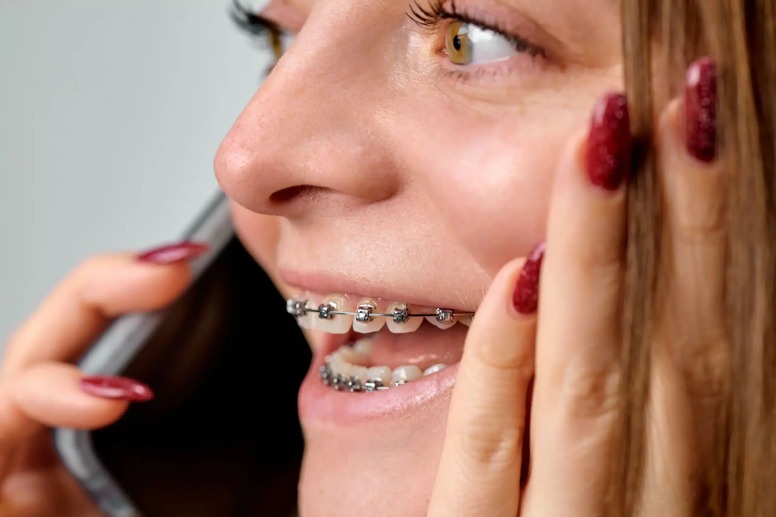 Ortodoncia En Adultos Mayores De 40 en madrid las tablas quintero dental