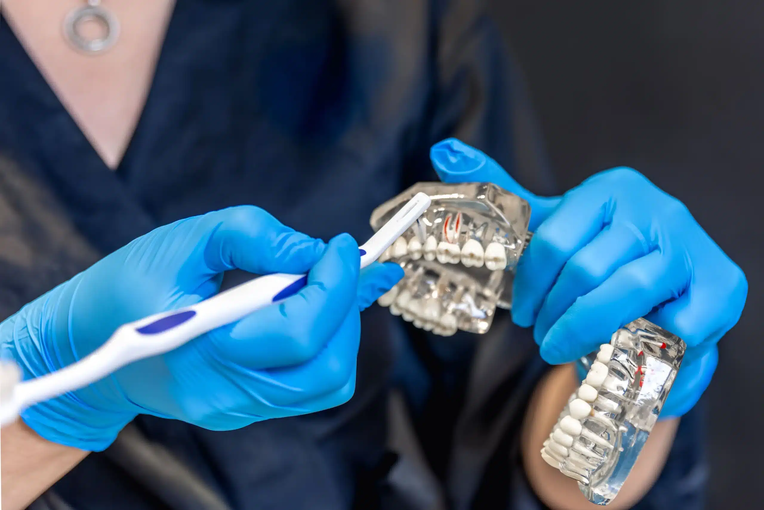 Por qué se mueven los dientes después de la ortodoncia en madrid las tablas retenedores quintero dental clinica dental