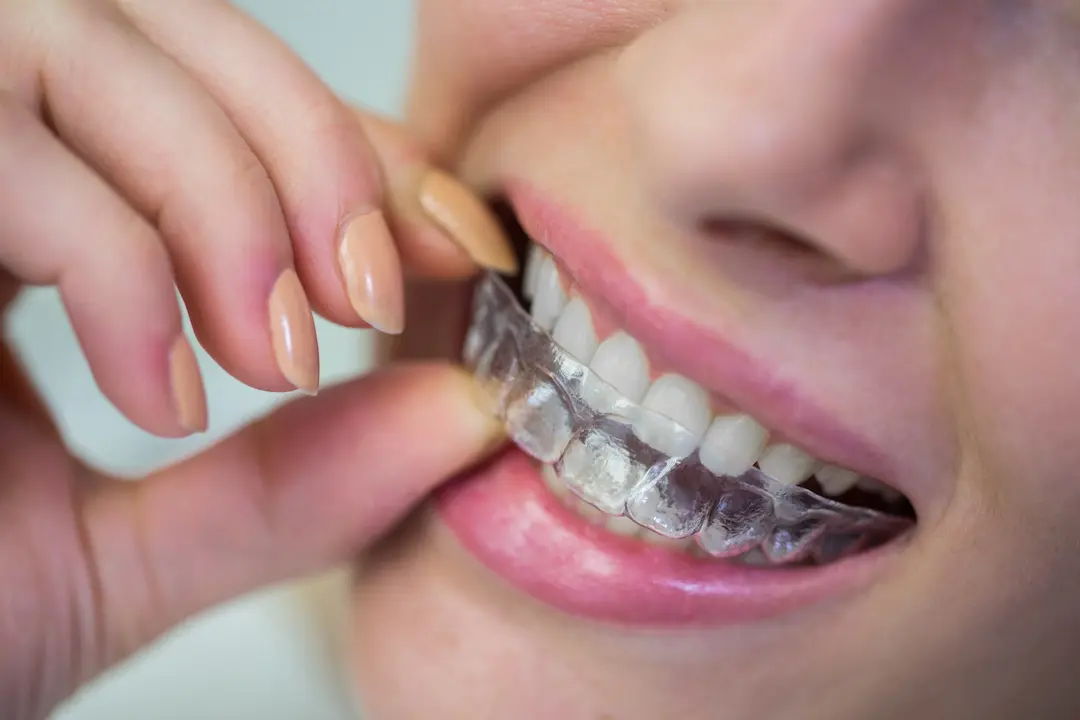 Clinica dental en madrid norte las tablas quintero dental
