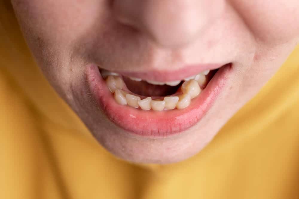 Clinica dental en madrid norte las tablas quintero dental