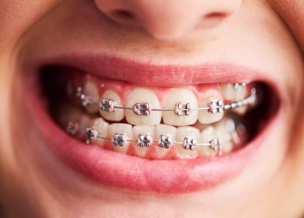 Clinica dental en madrid norte las tablas quintero dental